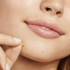 Acne Dots
