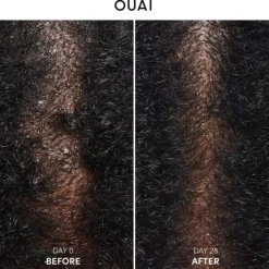Anti-Dandruff Shampoo