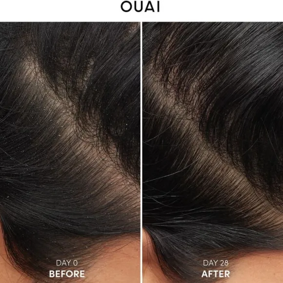 Anti-Dandruff Shampoo