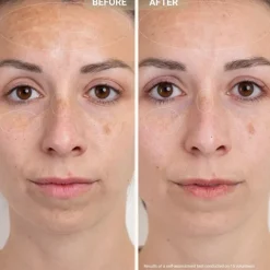 Anti-Redness Clarifying Care - Serum mot rodnad och orenheter