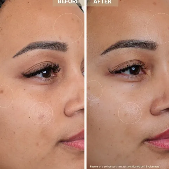 Anti-Redness Clarifying Care - Serum mot rodnad och orenheter