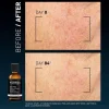 Clinical Home Peel Dark Spot 50 ml