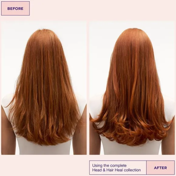 Head & Hair Heal Conditioner 300ml