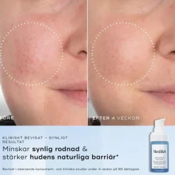 Niacinamide Peptides