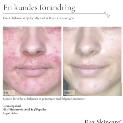 Raz Skincare Cleansing Mask 200 g