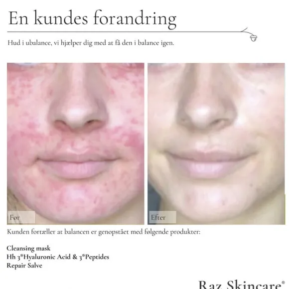 Raz Skincare Cleansing Mask 200 g