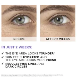 Revitalift Filler 2. 5% Hyaluronic Acid+Caffeine Eye Serum 20ml