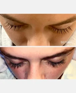 Vippeserum