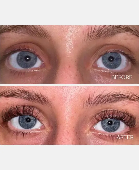 Vippeserum